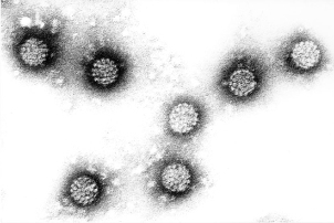 Virus du papillome humain